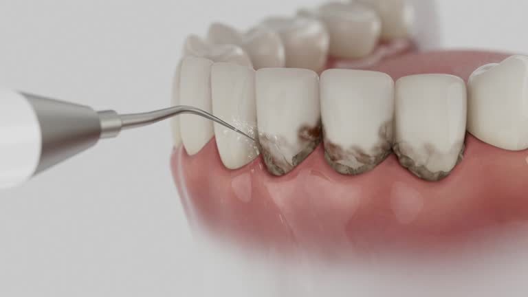 Reliable Dental contractor in Fort McKinley, OH by Dentist Open Now
